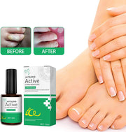 Active Corn Remover Gel