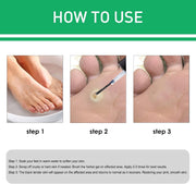 Active Corn Remover Gel