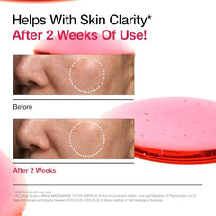 Anua Niacinamide TXA Serum