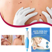 Auto Skin Tag Remover