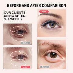 Retinol Eye Stick Balm