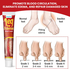 Leg Edema Relief Cream