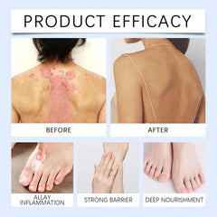 Sugarguard Foot Recovery Cream