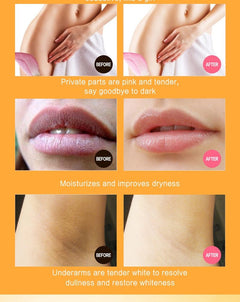 Dr Rashel - Vitamin C Privates Parts Whitening Cream